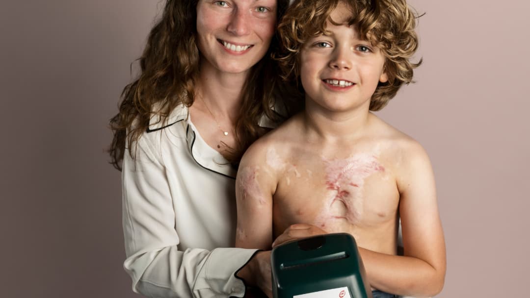 Nederlandse Brandwonden Stichting-actionPhoto (3)