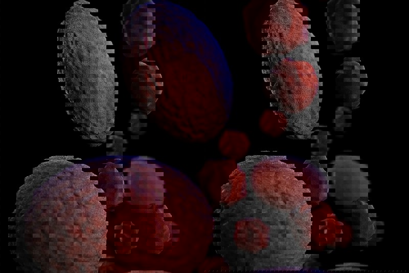 Fabry International Network