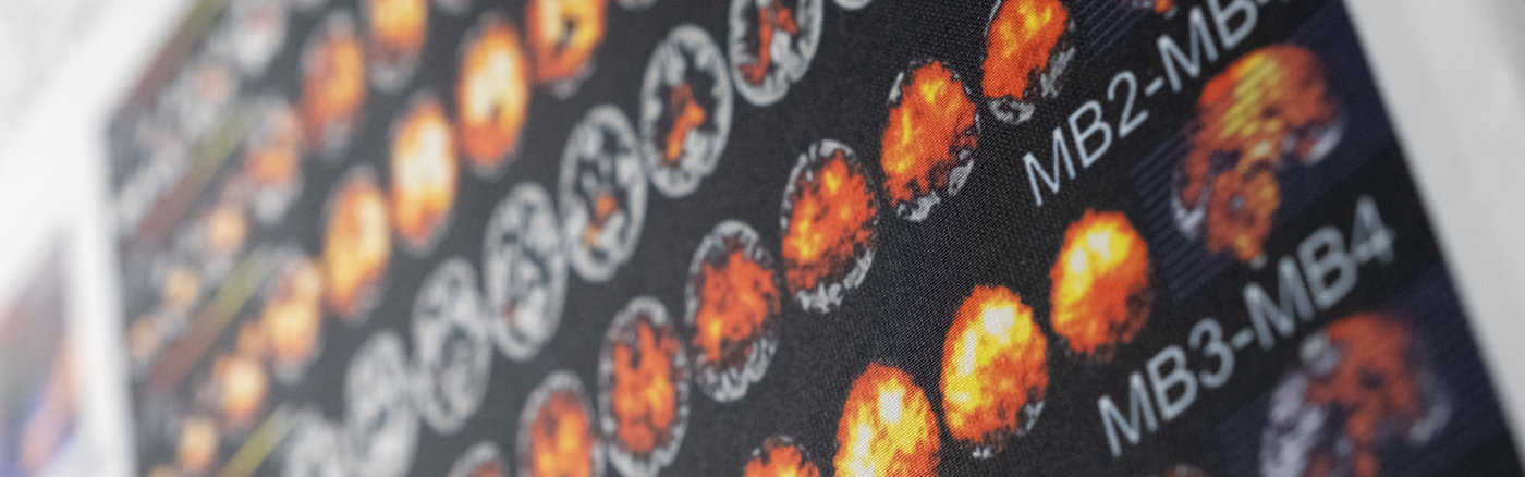 Interim vrijwilliger: Content Marketeer