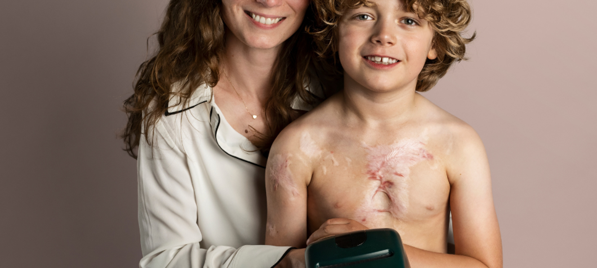 Nederlandse Brandwonden Stichting-actionPhoto (3)